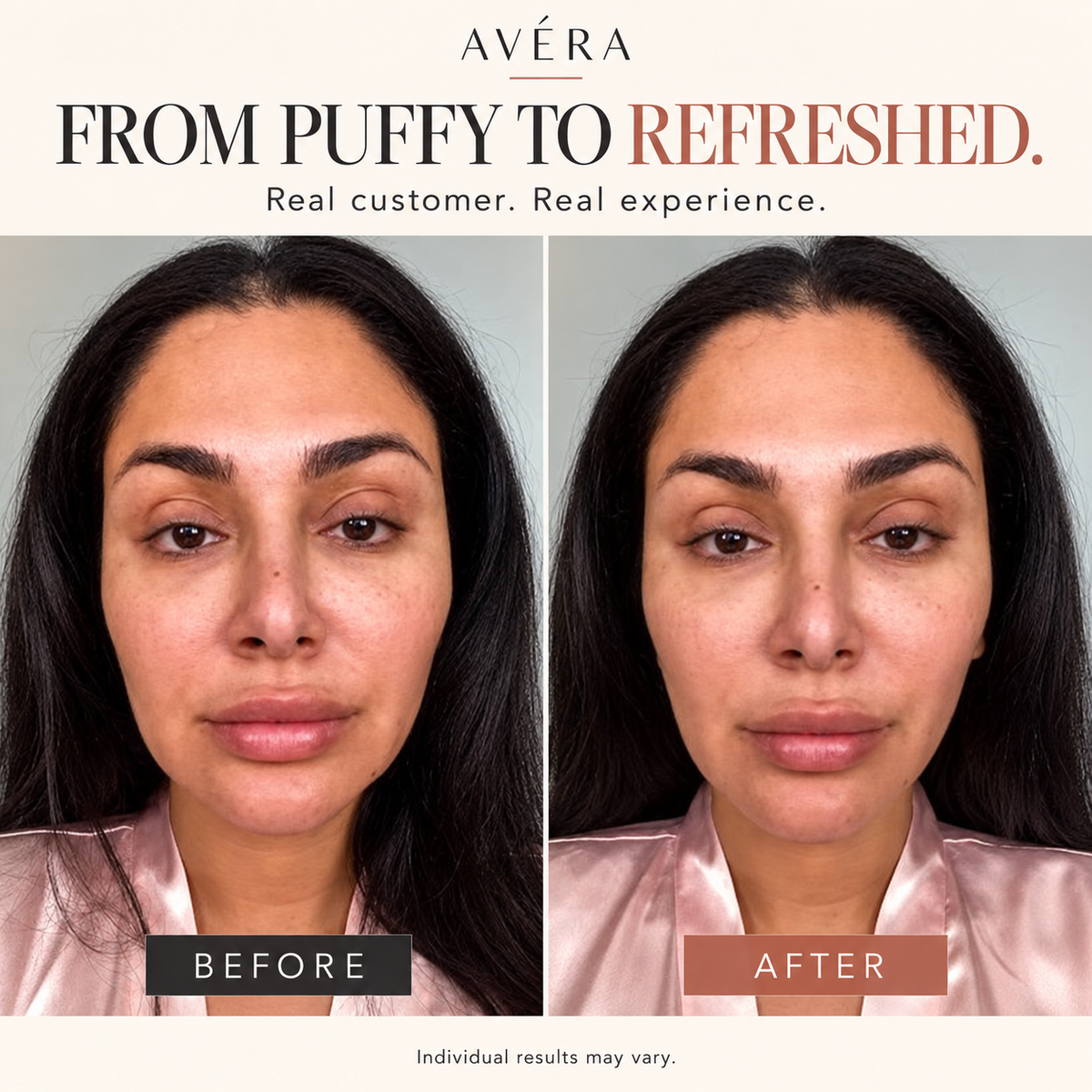 AVÉRA Sculpt | Facial Massager